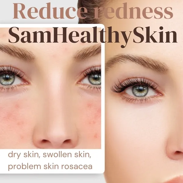 Clear skin transformation ad